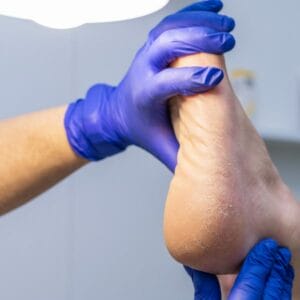 Podiatrist examining foot