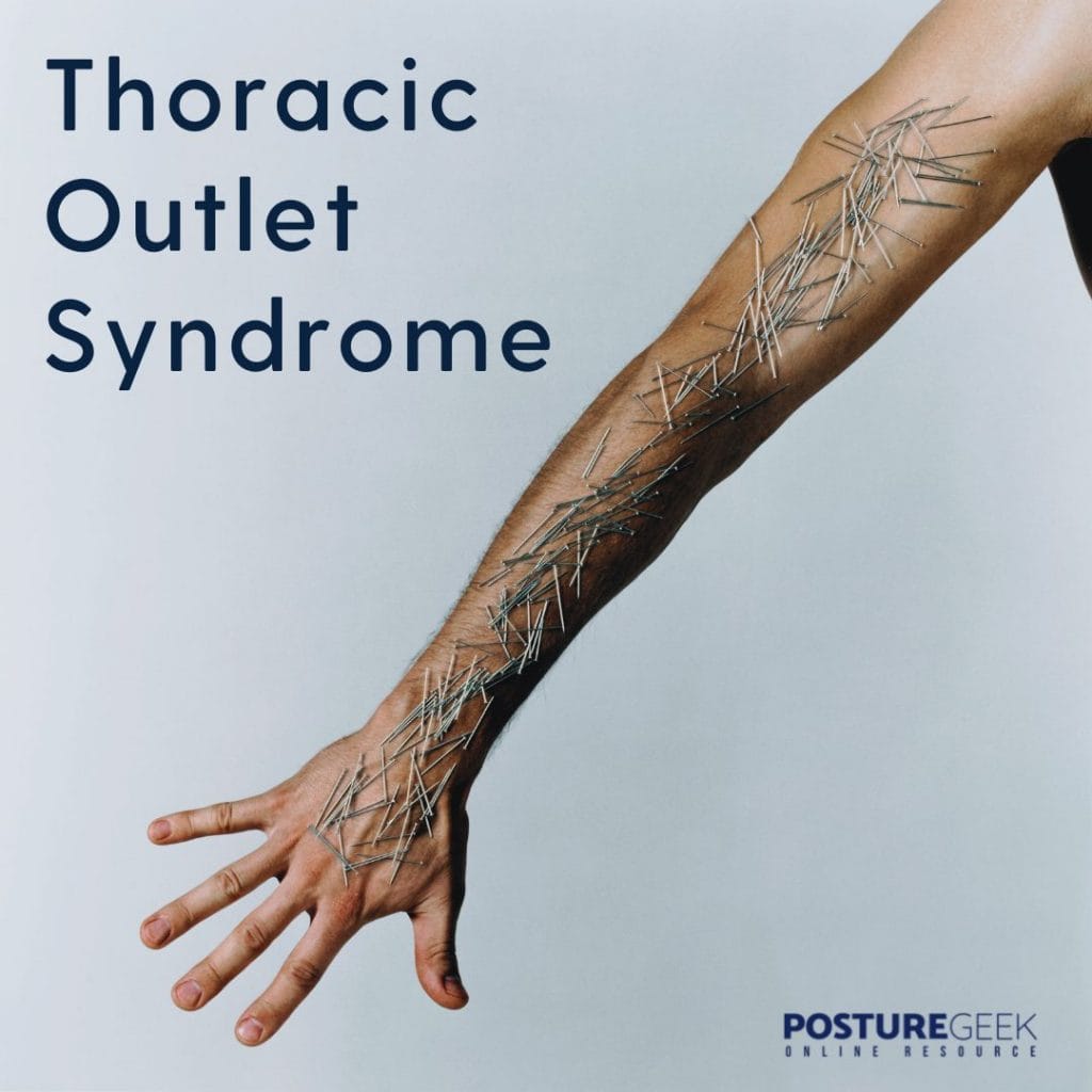 Thoracic Outlet Syndrome