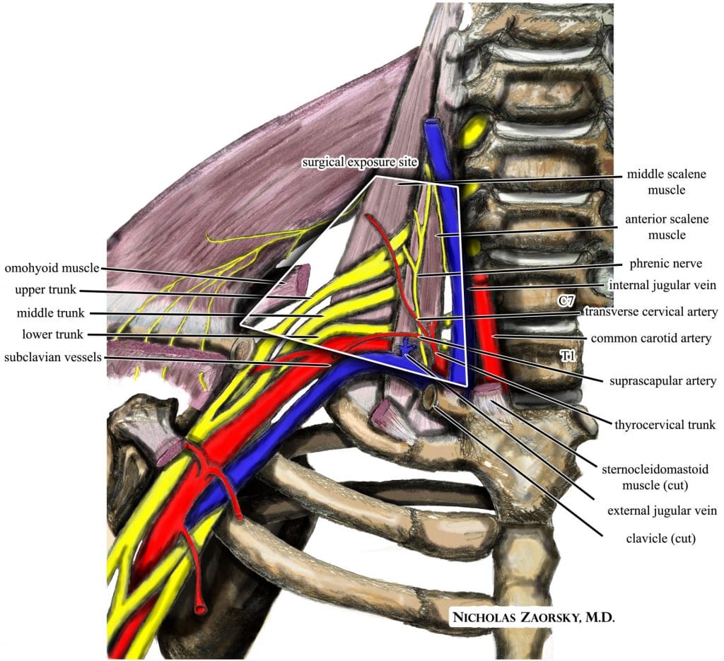 Thoracic Outlet