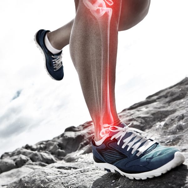 Ankle injuries can occur from jogging and running