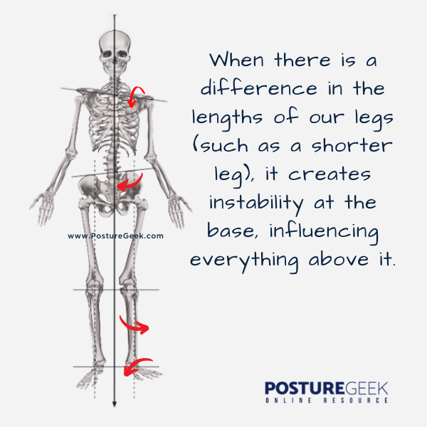 Leg Length Discrepancy - PostureGeek.com