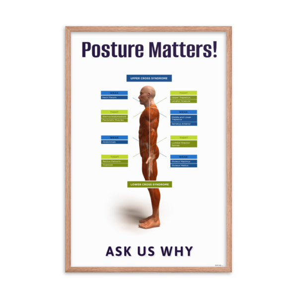 Janda’s Upper and Lower Cross Syndrome Educational Poster – Improve Posture - Image 8