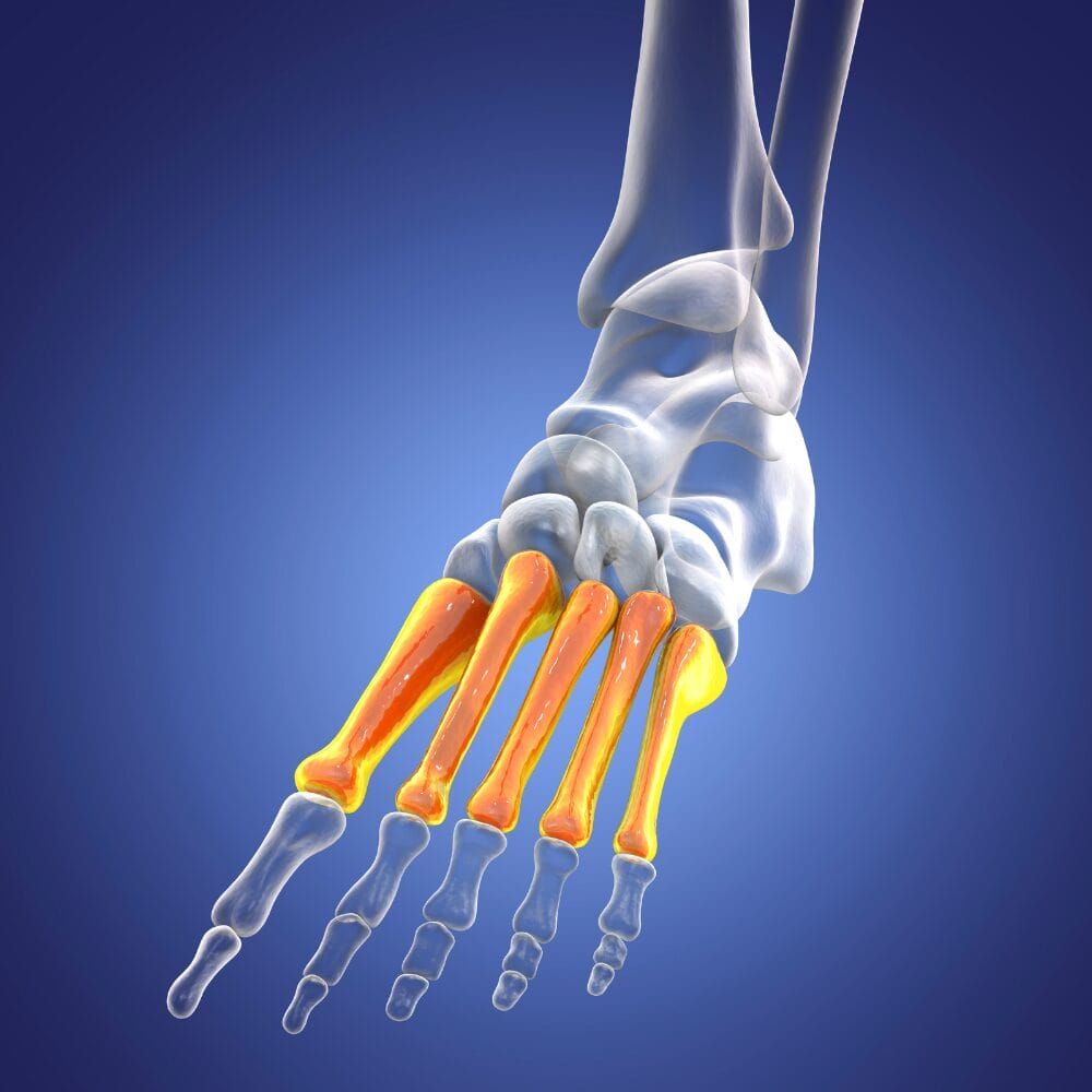 Metatarsals